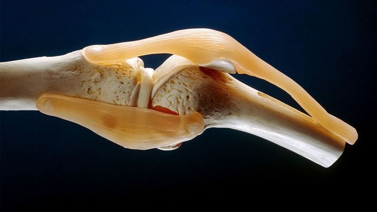 غضروف القرش للمفاصل