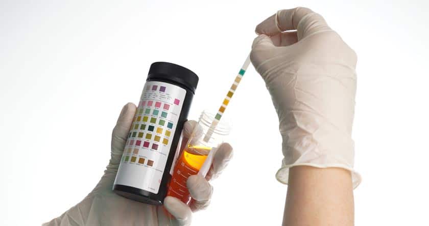 أعراض التهاب المثانة البولية وأفضل طرق العلاج