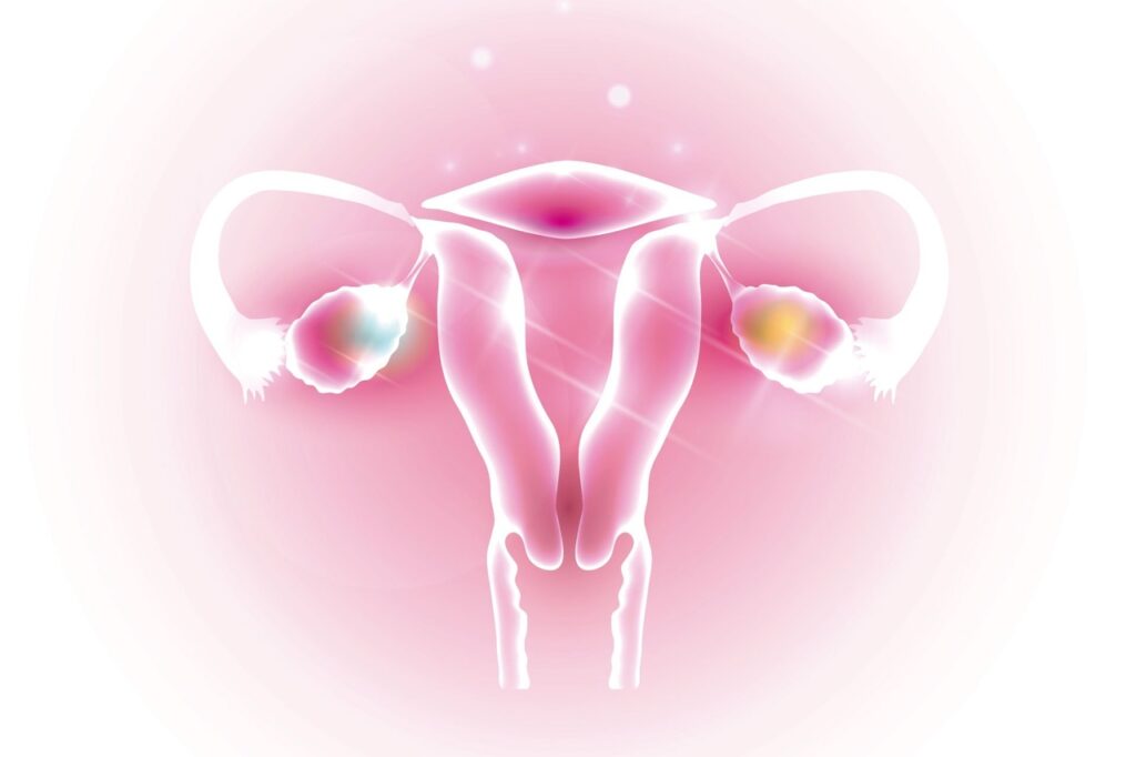 علاج متلازمة تكيس المبايض