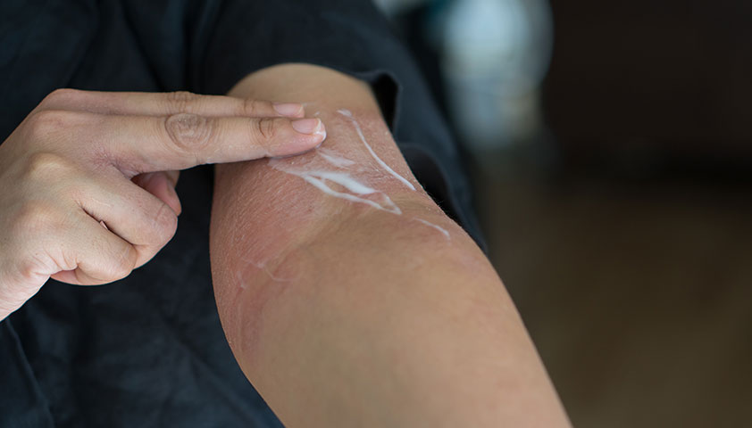 أنواع الأمراض الجلدية وعلاجها